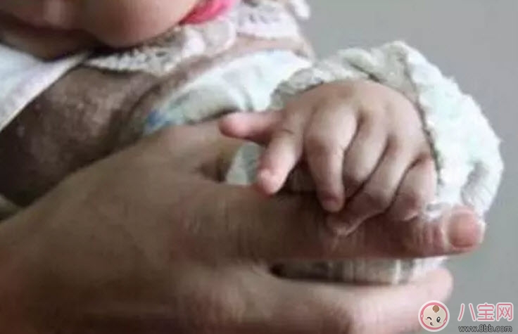 哪些孕婦易生畸形寶寶 做胎兒畸形的檢查有哪些