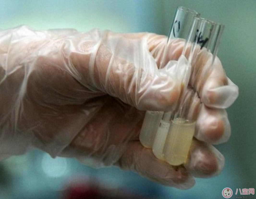 增強(qiáng)男性生育力 提高精子質(zhì)量