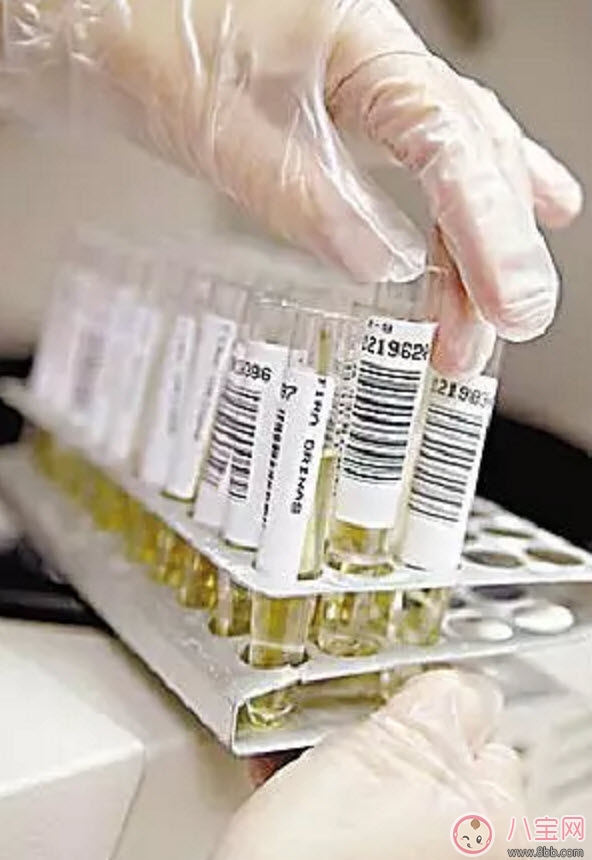 進(jìn)行驗孕前應(yīng)該知道哪些常識性問題 可能你還不知道 進(jìn)行驗孕前應(yīng)該知道哪些常識性問題 可能你還不知道