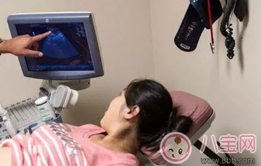 林心如愛(ài)吃甜食生女孩  懷孕如何測(cè)男女