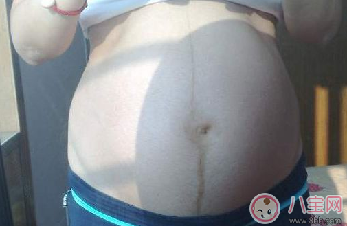 怎么通過妊娠紋判斷懷的是男是女 妊娠紋判斷性別方法 怎么通過妊娠紋判斷懷的是男是女 妊娠紋判斷性別方法