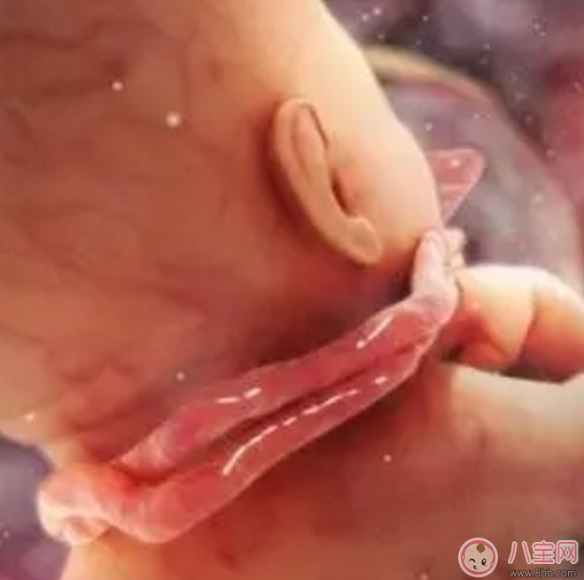 胎兒臍帶繞頸怎么辦？產(chǎn)前怎樣化解臍帶繞頸？