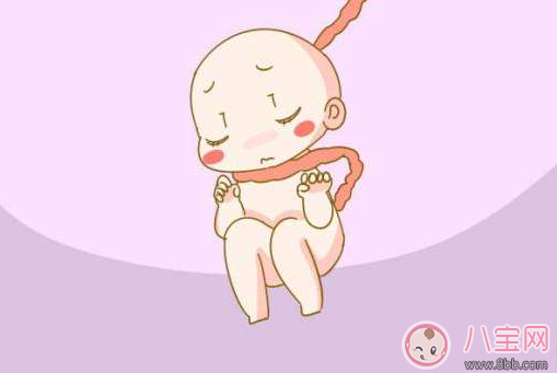 擔(dān)心胎兒臍帶繞頸怎么辦 預(yù)防臍帶繞頸方法推薦