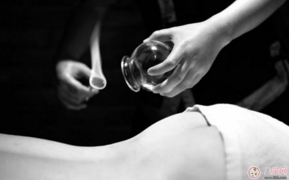 孕婦拔火罐可以嗎 孕婦肩膀能拔火罐嗎(孕婦拔過火罐怎么辦) 孕婦拔火罐可以嗎 孕婦肩膀能拔火罐嗎(孕婦拔過火罐怎么辦)