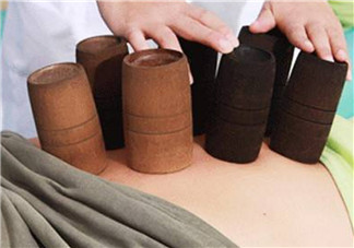 孕婦拔火罐可以嗎 孕婦肩膀能拔火罐嗎(孕婦拔過火罐怎么辦)