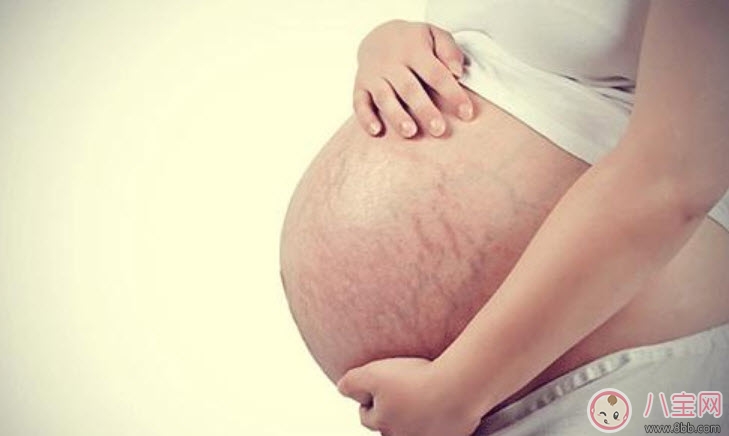 孕婦妊娠紋怎么預(yù)防 孕婦預(yù)防妊娠紋吃什么 孕婦妊娠紋怎么預(yù)防 孕婦預(yù)防妊娠紋吃什么