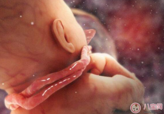 臍帶繞頸怎么辦 嬰兒臍帶繞頸嚴重嗎