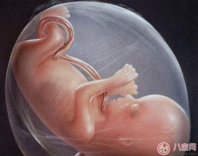 臍帶繞頸怎么辦 嬰兒臍帶繞頸嚴重嗎