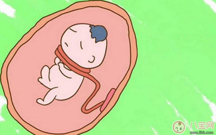 臍帶繞頸怎么辦 嬰兒臍帶繞頸嚴重嗎