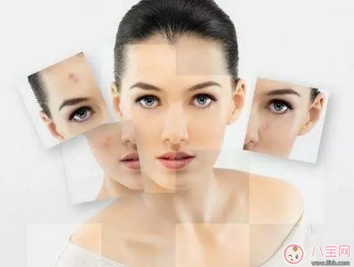 孕婦懷孕后身體哪個部位容易變黑呢 孕婦變黑對寶寶會有什么影響嗎