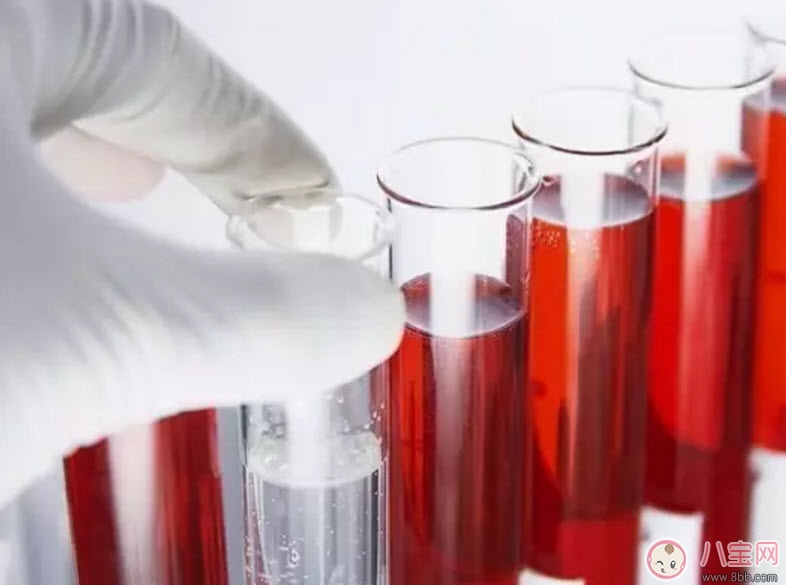 孕婦為什么要驗血型 哪些孕婦需要確定血型