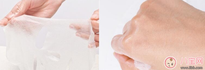 懷孕期間皮膚問題 懷孕期間有哪些皮膚問題