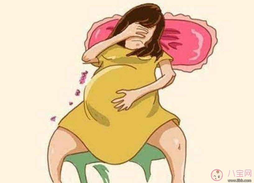 孕婦痔瘡怎么辦 孕婦痔瘡怎么治療(用什么藥)