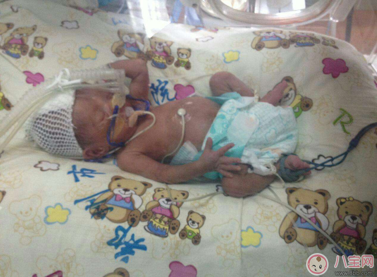 哪些準(zhǔn)媽媽容易早產(chǎn) 早產(chǎn)準(zhǔn)媽媽特征 哪些準(zhǔn)媽媽容易早產(chǎn) 早產(chǎn)準(zhǔn)媽媽特征