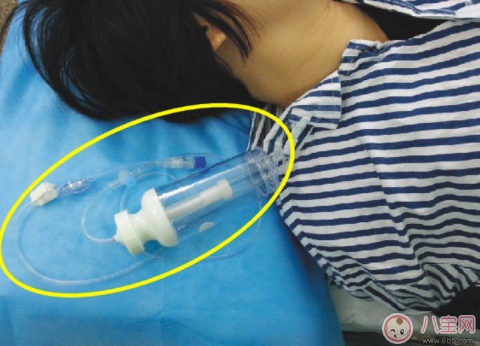 剖腹產(chǎn)的過程是怎么樣的 剖腹產(chǎn)手術(shù)前手術(shù)中手術(shù)后流程揭秘 剖腹產(chǎn)的過程是怎么樣的 剖腹產(chǎn)手術(shù)前手術(shù)中手術(shù)后流程揭秘