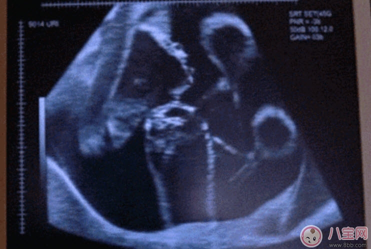 孕晚期胎動(dòng)頻繁正常嗎 孕晚期胎動(dòng)時(shí)間 孕晚期胎動(dòng)頻繁正常嗎 孕晚期胎動(dòng)時(shí)間