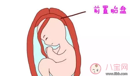 什么是孕晚期見紅 孕晚期見紅肚子疼怎么辦 什么是孕晚期見紅 孕晚期見紅肚子疼怎么辦