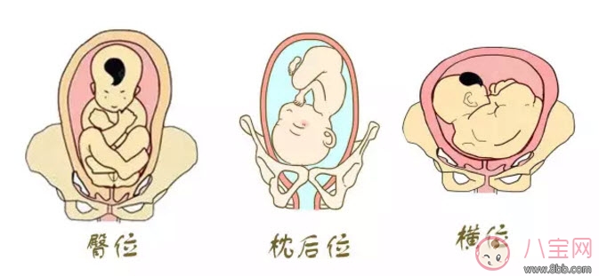 孕晚期胎位不正怎么辦 孕晚期胎位圖 孕晚期胎位不正怎么辦 孕晚期胎位圖
