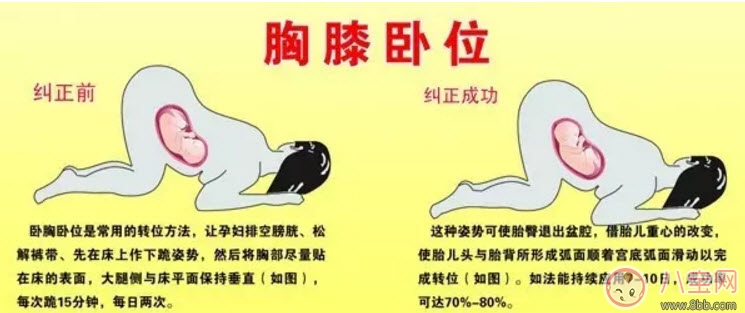 孕晚期胎位不正怎么辦 孕晚期胎位圖 孕晚期胎位不正怎么辦 孕晚期胎位圖