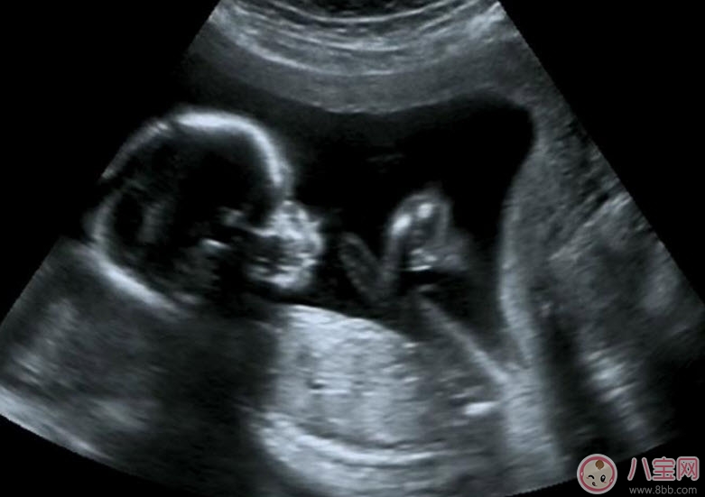 孕早期B超作用是什么有什么講究 孕早期陰道B超對胎兒有影響嗎 孕早期B超作用是什么有什么講究 孕早期陰道B超對胎兒有影響嗎