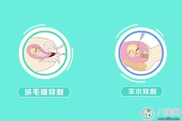 從懷孕到生要做幾次b超 懷孕做多少次b超合適(孕期b超時間表)