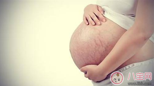 妊娠紋什么時候長 怎么預(yù)防妊娠紋 妊娠紋什么時候長 怎么預(yù)防妊娠紋