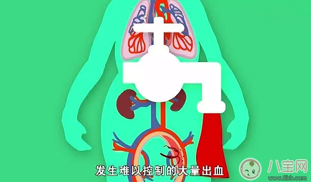 哪些人更容易產(chǎn)后出血 產(chǎn)后出血發(fā)病癥狀(如何預防產(chǎn)后大出血) 哪些人更容易產(chǎn)后出血 產(chǎn)后出血發(fā)病癥狀(如何預防產(chǎn)后大出血)