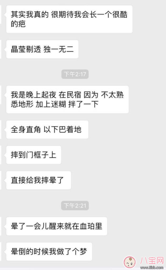 周冬雨下巴為什么會出現(xiàn)疤痕 周冬雨下巴受傷的原因