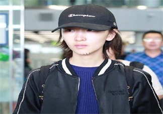 周冬雨下巴為什么會出現(xiàn)疤痕 周冬雨下巴受傷的原因