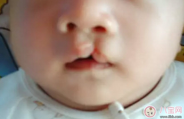 孕婦能吃兔肉嗎 孕婦吃兔肉對寶寶有什么好處 孕婦能吃兔肉嗎 孕婦吃兔肉對寶寶有什么好處