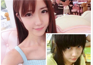 米咪黑歷史米咪天涯微博黑歷史扒皮 米咪整容前后圖片