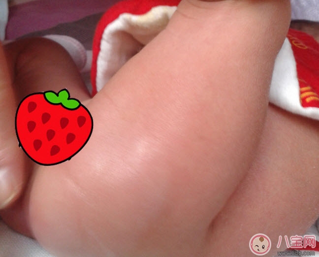貝親護(hù)臀膏可以擦臉嗎 貝親嬰兒護(hù)臀膏能天天用嗎