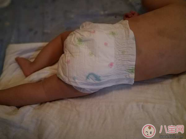 寶寶覺得穿紙尿褲悶怎么辦 推薦兩款透氣型紙尿褲 寶寶覺得穿紙尿褲悶怎么辦 推薦兩款透氣型紙尿褲