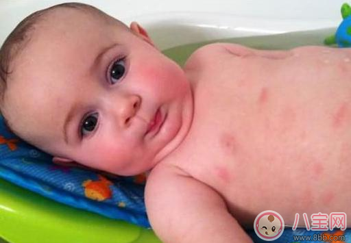 這些情況居然是奶粉過(guò)敏 怎么知道孩子吃奶粉過(guò)敏了