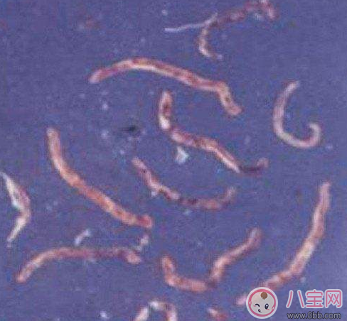 喝生水長寄生蟲是真的嗎 喝生水會有寄生蟲嗎