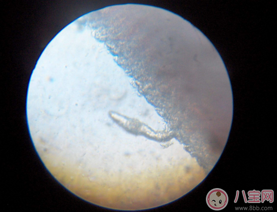 喝生水長寄生蟲是真的嗎 喝生水會有寄生蟲嗎