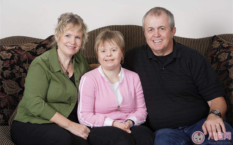 唐氏癥寶寶典型癥狀 如何治療唐氏癥寶寶 唐氏癥寶寶典型癥狀 如何治療唐氏癥寶寶