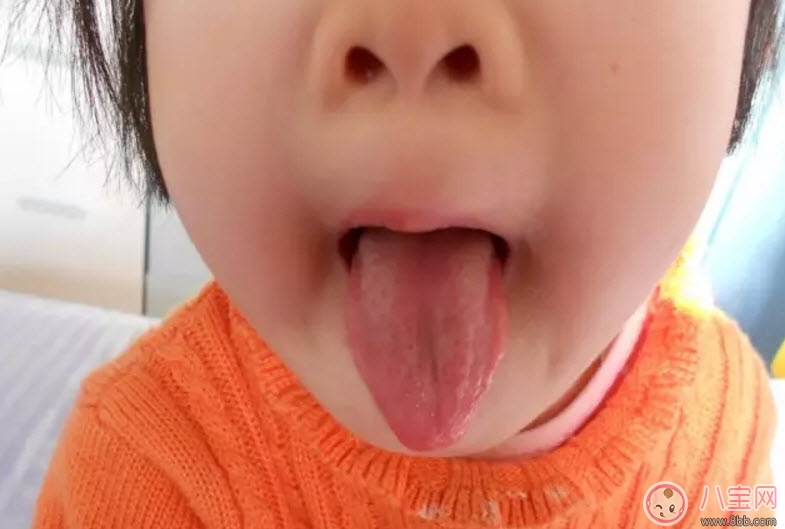 寶寶積食發(fā)燒和感冒發(fā)燒的區(qū)別癥狀 寶寶積食發(fā)燒怎么解決 寶寶積食發(fā)燒和感冒發(fā)燒的區(qū)別癥狀 寶寶積食發(fā)燒怎么解決