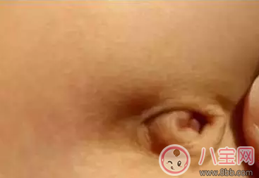 孩子肚臍臟了怎么辦 就算你有強(qiáng)迫癥也不能摳 孩子肚臍臟了怎么辦 就算你有強(qiáng)迫癥也不能摳