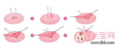 母乳喂養(yǎng)很艱難 別不小心走到坑里面去了 母乳喂養(yǎng)很艱難 別不小心走到坑里面去了