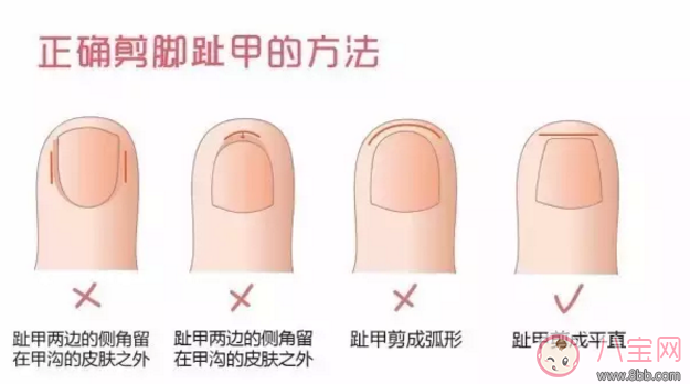 錯誤的方法剪指甲會剪到肉 怎么給孩子剪指甲