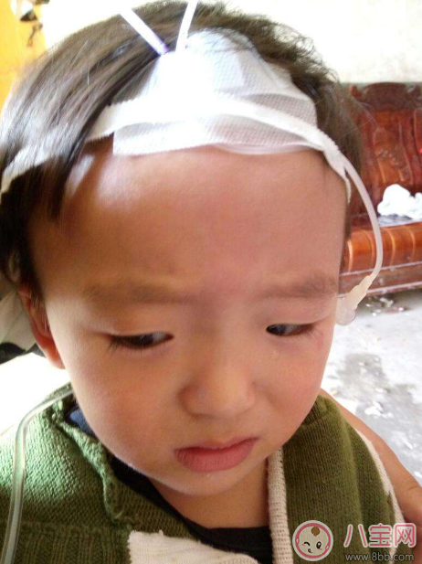 秋季腹瀉孩子狀態(tài)差 及時(shí)預(yù)防遠(yuǎn)離它