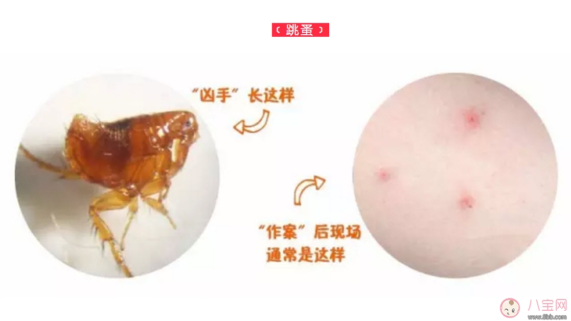 寶寶被跳蚤咬了癥狀圖片 寶寶被跳蚤咬和蚊子咬癥狀對比圖片區(qū)別 寶寶被跳蚤咬了癥狀圖片 寶寶被跳蚤咬和蚊子咬癥狀對比圖片區(qū)別