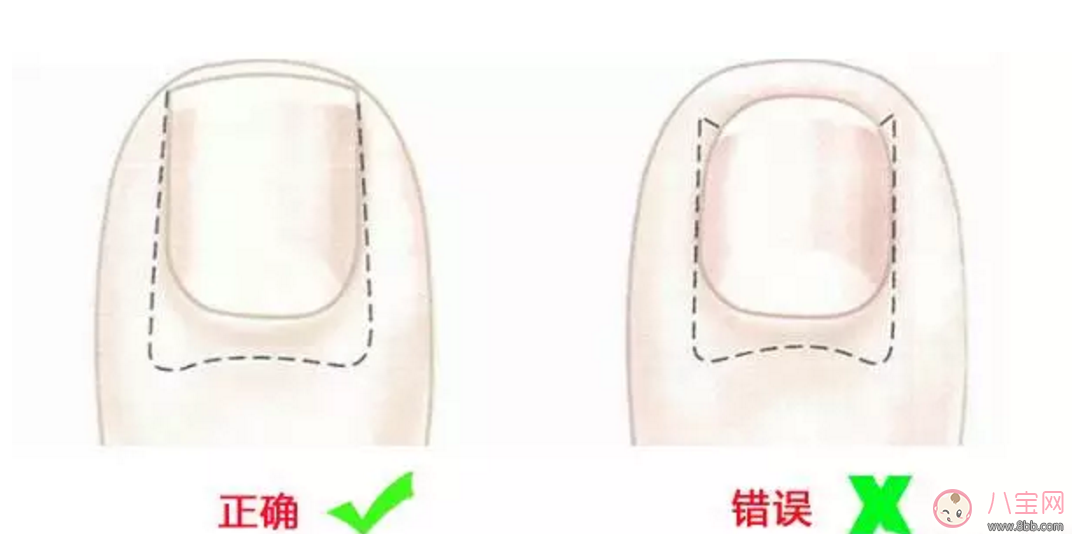 給寶寶剪指甲如何避免錯誤 如何正確的給寶寶剪指甲 給寶寶剪指甲如何避免錯誤 如何正確的給寶寶剪指甲