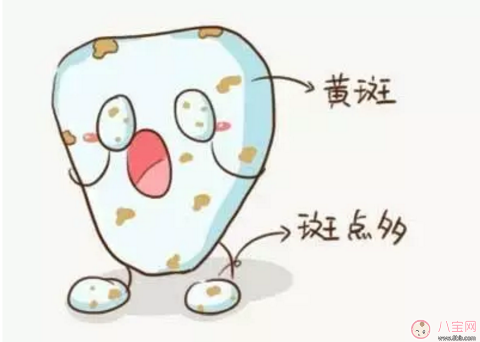 寶寶沒有齲齒 卻有黑牙是怎么回事？