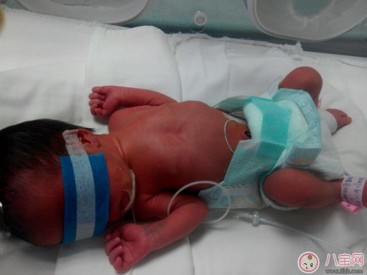 早產(chǎn)寶寶太小怎么照顧 各項(xiàng)注意到一樣是個(gè)健康寶寶