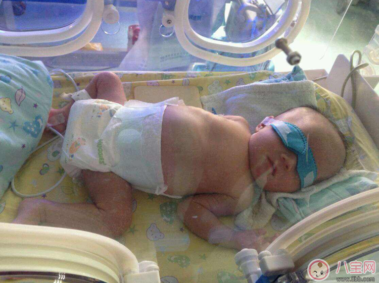 早產(chǎn)寶寶太小怎么照顧 各項(xiàng)注意到一樣是個(gè)健康寶寶