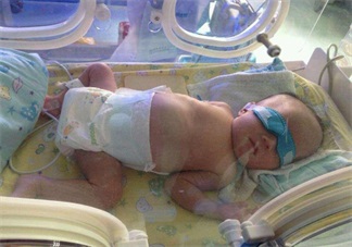 早產(chǎn)寶寶太小怎么照顧 各項注意到一樣是個健康寶寶