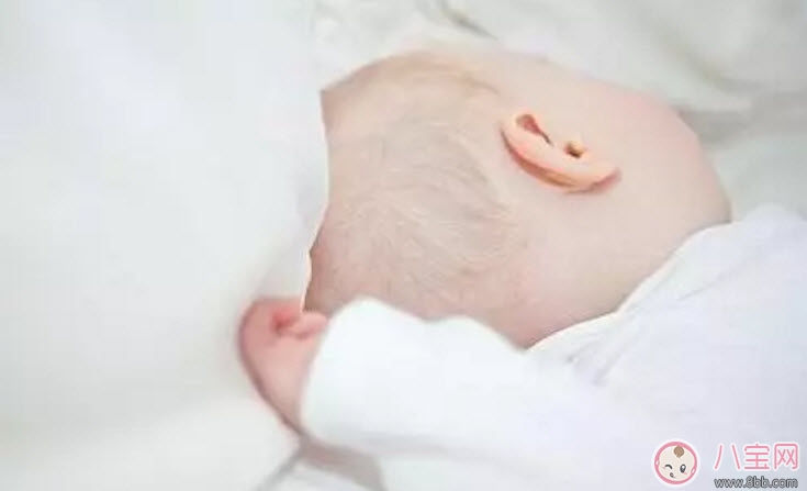 新生兒頭上的乳痂一般什么時(shí)候消失 為什么有的寶寶長(zhǎng)乳痂有的不長(zhǎng)