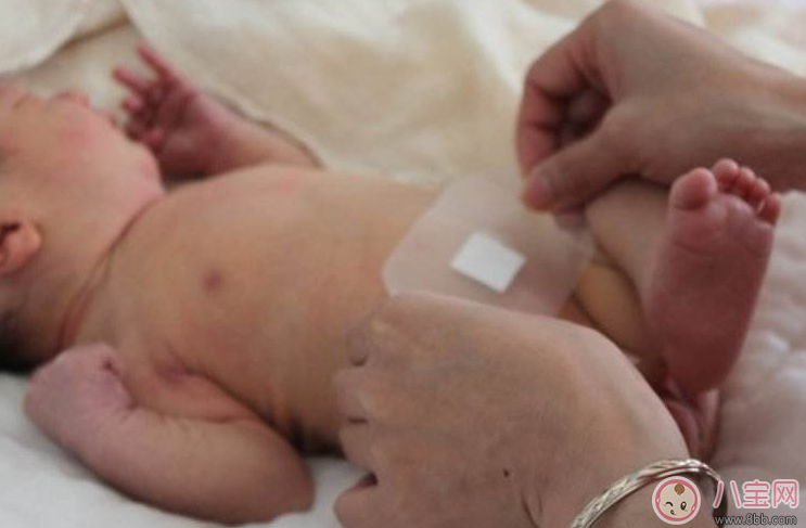 看到孩子肚臍這四種情況要當(dāng)心 最好早點(diǎn)及時(shí)就醫(yī) 看到孩子肚臍這四種情況要當(dāng)心 最好早點(diǎn)及時(shí)就醫(yī)